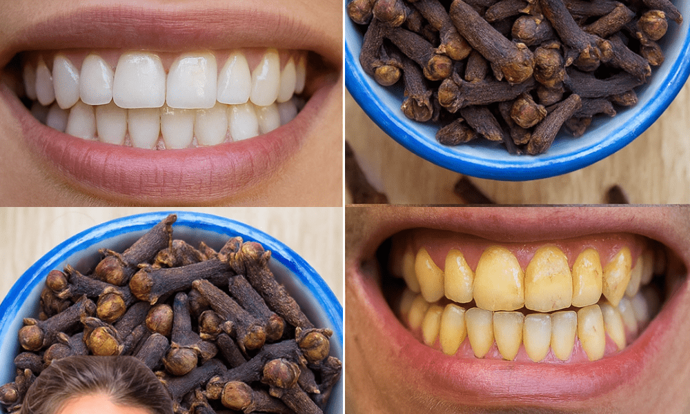 Cloves: The Tiny Spice That Transforms Your Oral Health