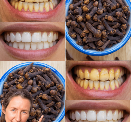 Cloves: The Tiny Spice That Transforms Your Oral Health Cloves: The Tiny Spice That Transforms Your Oral Health