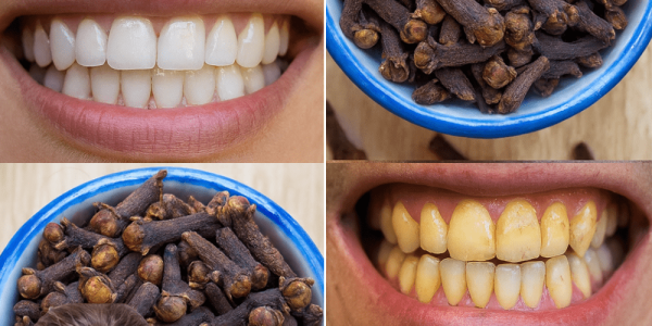 Cloves: The Tiny Spice That Transforms Your Oral Health