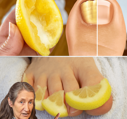 🍋 Zest Away Toenail Fungus: The Surprising Power of Lemon for Healthier Nails 🍋 Zest Away Toenail Fungus: The Surprising Power of Lemon for Healthier Nails