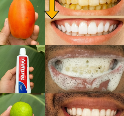 🌟 Banish Yellow Teeth with This Zesty Natural Recipe: A Brighter Smile in Minutes! 🌟 Banish Yellow Teeth with This Zesty Natural Recipe: A Brighter Smile in Minutes!