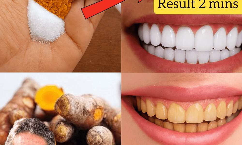 đ Unveiled Secret: Whiten Your Teeth and Banish Tartar in Just 2 Minutes! đ Unveiled Secret: Whiten Your Teeth and Banish Tartar in Just 2 Minutes!