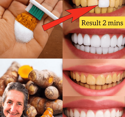 😁 Unveiled Secret: Whiten Your Teeth and Banish Tartar in Just 2 Minutes! 😁 Unveiled Secret: Whiten Your Teeth and Banish Tartar in Just 2 Minutes!