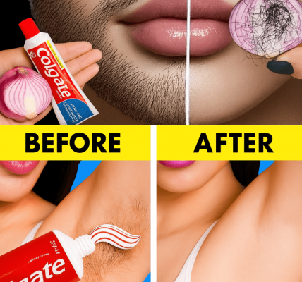 Ditch the Razor: The Surprising Onion & Toothpaste Hack for Painless Hair Removal! 🧅🪥 Ditch the Razor: The Surprising Onion & Toothpaste Hack for Painless Hair Removal! 🧅🪥