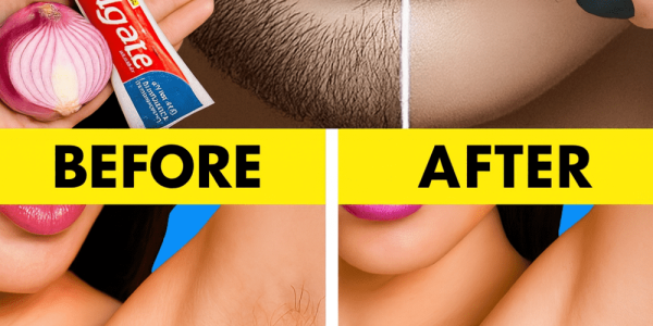 Ditch the Razor: The Surprising Onion & Toothpaste Hack for Painless Hair Removal! 🧅🪥 Ditch the Razor: The Surprising Onion & Toothpaste Hack for Painless Hair Removal! 🧅🪥