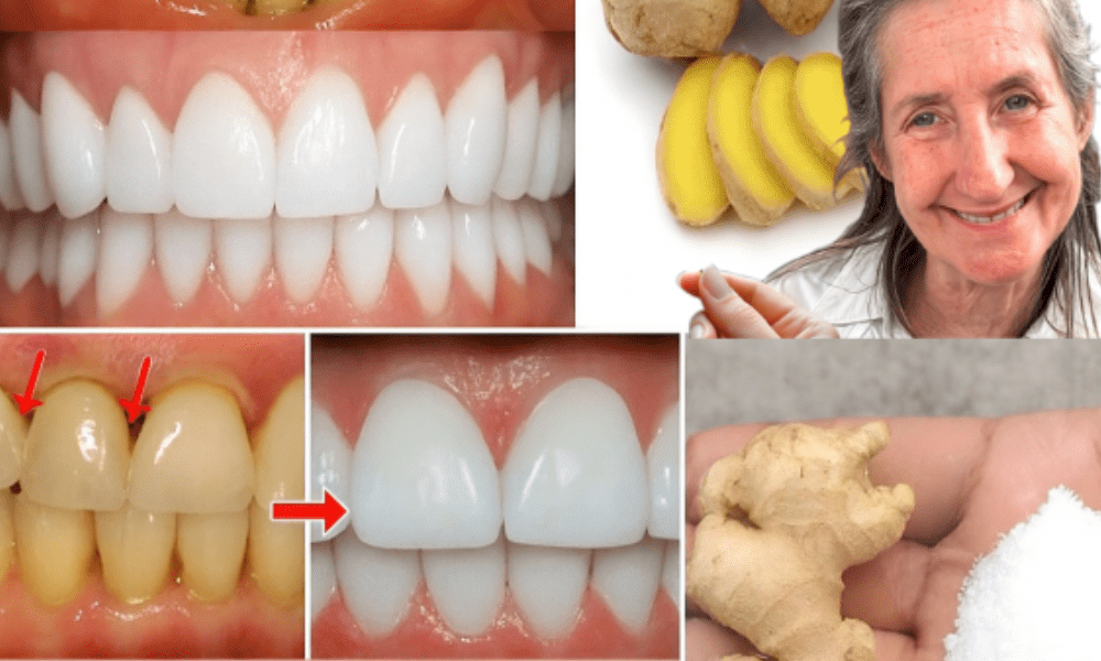 🌟 Can Ginger and Salt Transform Your Smile? The Natural Whitening Secret Unveiled 🌟 Can Ginger and Salt Transform Your Smile? The Natural Whitening Secret Unveiled