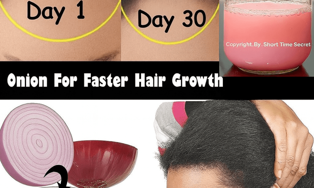 🌿 Unlock Thicker, Stronger Hair: The 7-Day Onion Juice Miracle for Your Scalp 🌿 Unlock Thicker, Stronger Hair: The 7-Day Onion Juice Miracle for Your Scalp