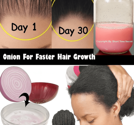 🌿 Unlock Thicker, Stronger Hair: The 7-Day Onion Juice Miracle for Your Scalp 🌿 Unlock Thicker, Stronger Hair: The 7-Day Onion Juice Miracle for Your Scalp