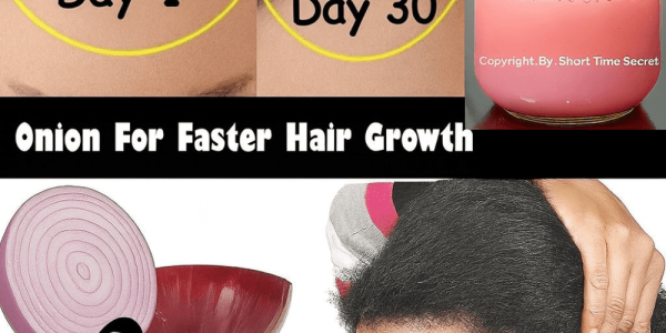 🌿 Unlock Thicker, Stronger Hair: The 7-Day Onion Juice Miracle for Your Scalp 🌿 Unlock Thicker, Stronger Hair: The 7-Day Onion Juice Miracle for Your Scalp
