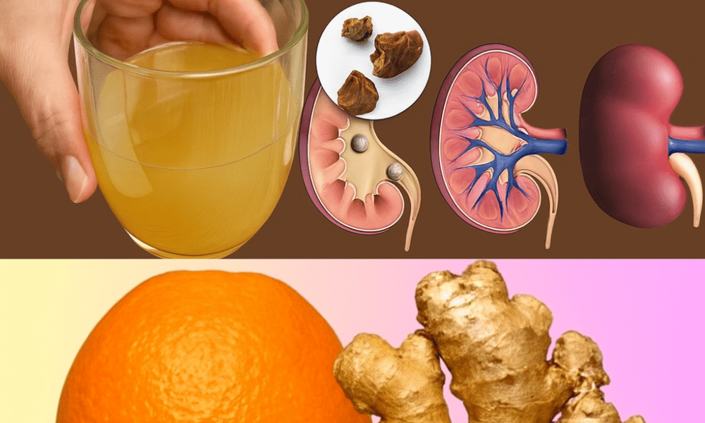 š Discover the Tangerine, Walnut, and Ginger Detox: Natureās Ultimate Cleanse for Kidneys, Liver, and Lungs š Discover the Tangerine, Walnut, and Ginger Detox: Natureās Ultimate Cleanse for Kidneys, Liver, and Lungs