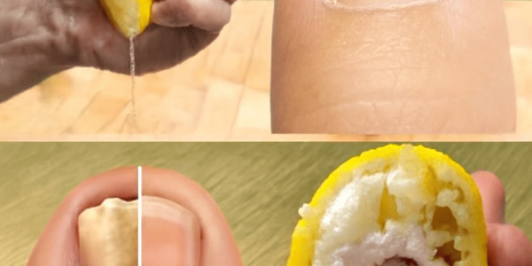 🌿 Banish Toenail Fungus Forever: The Astonishing Power of Lemon and Garlic