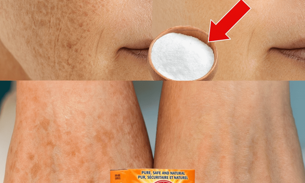 Erase Age Spots Naturally: The Baking Soda Secret Hiding in Your Kitchen Erase Age Spots Naturally: The Baking Soda Secret Hiding in Your Kitchen