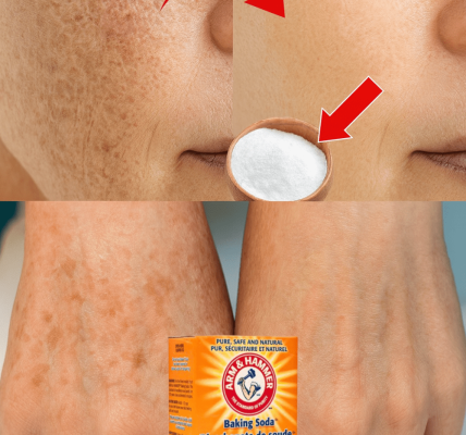 Erase Age Spots Naturally: The Baking Soda Secret Hiding in Your Kitchen Erase Age Spots Naturally: The Baking Soda Secret Hiding in Your Kitchen