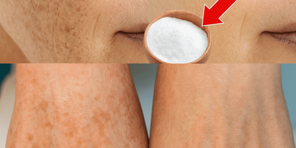 Erase Age Spots Naturally: The Baking Soda Secret Hiding in Your Kitchen Erase Age Spots Naturally: The Baking Soda Secret Hiding in Your Kitchen