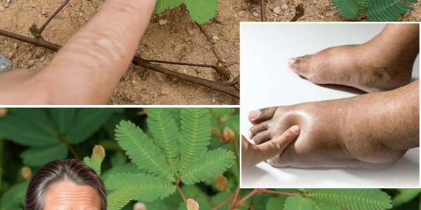 🌿 The Hidden Power of Mimosa Pudica: 30 Remarkable Benefits and DIY Uses to Transform Your Health 🌿 The Hidden Power of Mimosa Pudica: 30 Remarkable Benefits and DIY Uses to Transform Your Health