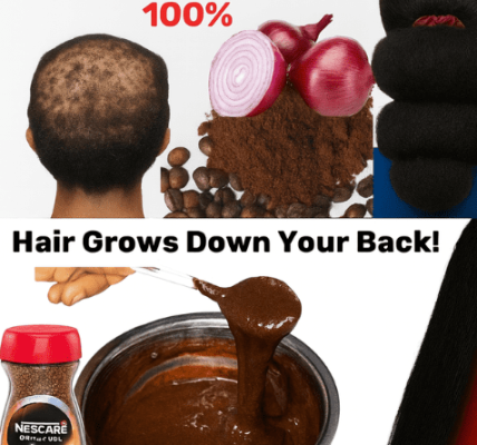 🌟 Unlock x10 Faster Hair Growth with Onion & Coffee: The Ultimate Natural Secret 🌟 Unlock x10 Faster Hair Growth with Onion & Coffee: The Ultimate Natural Secret