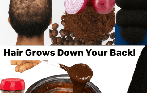🌟 Unlock x10 Faster Hair Growth with Onion & Coffee: The Ultimate Natural Secret 🌟 Unlock x10 Faster Hair Growth with Onion & Coffee: The Ultimate Natural Secret