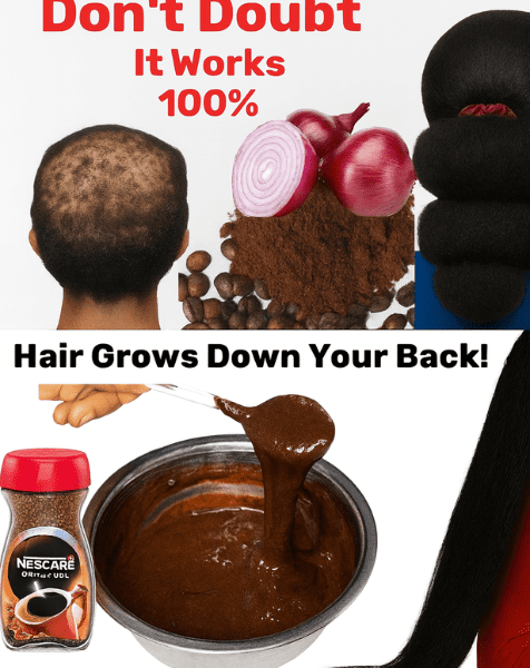 🌟 Unlock x10 Faster Hair Growth with Onion & Coffee: The Ultimate Natural Secret 🌟 Unlock x10 Faster Hair Growth with Onion & Coffee: The Ultimate Natural Secret