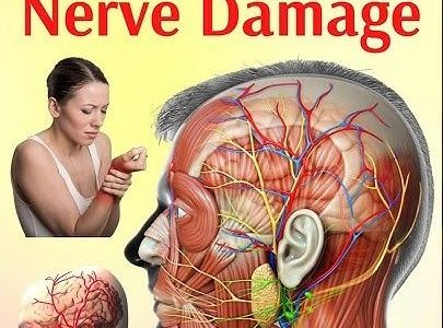 4 Incredible Vitamins to Repair Nerve Damage Naturally 4 Incredible Vitamins to Repair Nerve Damage Naturally