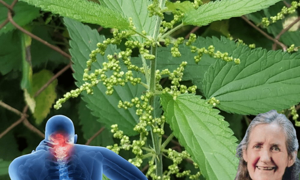 Stinging Nettle Unveiled: 17 Astonishing Remedies to Revolutionize Your Health Naturally 🌿 Stinging Nettle Unveiled: 17 Astonishing Remedies to Revolutionize Your Health Naturally 🌿