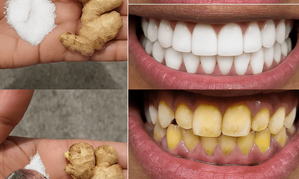 š Unlock a Dazzling Smile in Just 2 Minutes: The Ginger & Salt Teeth-Whitening Secret š Unlock a Dazzling Smile in Just 2 Minutes: The Ginger & Salt Teeth-Whitening Secret