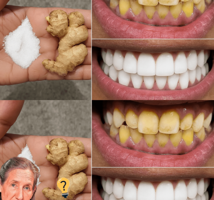 š Unlock a Dazzling Smile in Just 2 Minutes: The Ginger & Salt Teeth-Whitening Secret š Unlock a Dazzling Smile in Just 2 Minutes: The Ginger & Salt Teeth-Whitening Secret