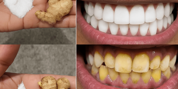 😁 Unlock a Dazzling Smile in Just 2 Minutes: The Ginger & Salt Teeth-Whitening Secret 😁 Unlock a Dazzling Smile in Just 2 Minutes: The Ginger & Salt Teeth-Whitening Secret