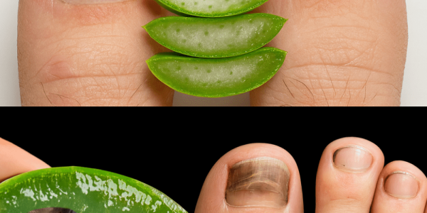 🔥 Banish Nail Fungus Fast: The Ultimate Aloe Vera Remedy for Clear, Healthy Nails