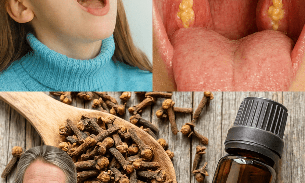 🌟 Cloves: Nature’s Tiny Powerhouse to Crush Sore Throats and Inflammation 🌟 Cloves: Nature’s Tiny Powerhouse to Crush Sore Throats and Inflammation