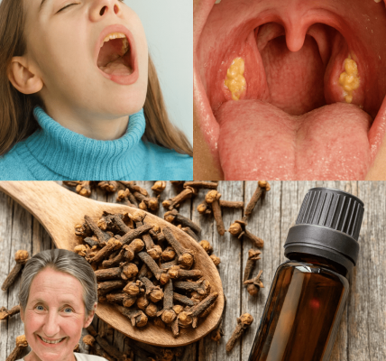 🌟 Cloves: Nature’s Tiny Powerhouse to Crush Sore Throats and Inflammation 🌟 Cloves: Nature’s Tiny Powerhouse to Crush Sore Throats and Inflammation