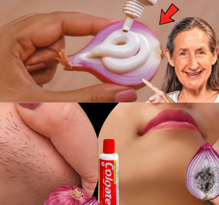 🧴🧅 Ditch the Razor: The Toothpaste & Onion Hair Removal Hack That’s Changing Beauty Routines in 2025 🧴🧅 Ditch the Razor: The Toothpaste & Onion Hair Removal Hack That’s Changing Beauty Routines in 2025
