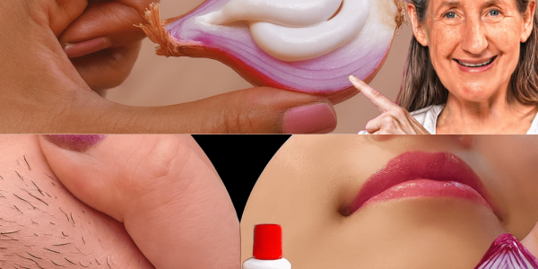 🧴🧅 Ditch the Razor: The Toothpaste & Onion Hair Removal Hack That’s Changing Beauty Routines in 2025 🧴🧅 Ditch the Razor: The Toothpaste & Onion Hair Removal Hack That’s Changing Beauty Routines in 2025