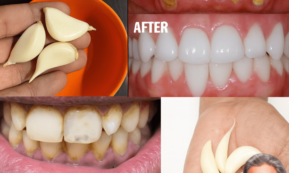 Discover the Secret to a Dazzling Smile: Whiten Your Teeth Naturally in Just 3 Minutes! š Discover the Secret to a Dazzling Smile: Whiten Your Teeth Naturally in Just 3 Minutes! š