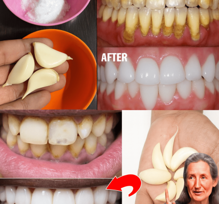 Discover the Secret to a Dazzling Smile: Whiten Your Teeth Naturally in Just 3 Minutes! 😁 Discover the Secret to a Dazzling Smile: Whiten Your Teeth Naturally in Just 3 Minutes! 😁