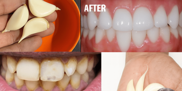 Discover the Secret to a Dazzling Smile: Whiten Your Teeth Naturally in Just 3 Minutes! 😁 Discover the Secret to a Dazzling Smile: Whiten Your Teeth Naturally in Just 3 Minutes! 😁