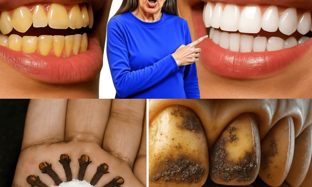 🌿 Discover the Secret Spice for a Dazzling Smile: Chewing Cloves Daily 🌿 Discover the Secret Spice for a Dazzling Smile: Chewing Cloves Daily