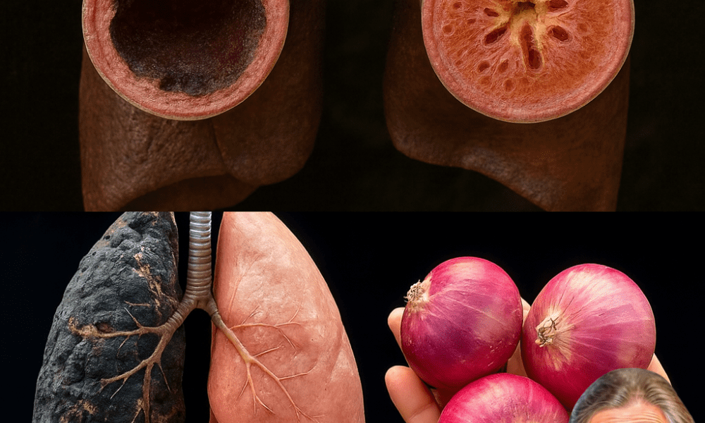 š¬ļø Struggling with a Stubborn Cough or Clogged Lungs? Discover the Onion Remedy That Works Wonders! š¬ļø Struggling with a Stubborn Cough or Clogged Lungs? Discover the Onion Remedy That Works Wonders!