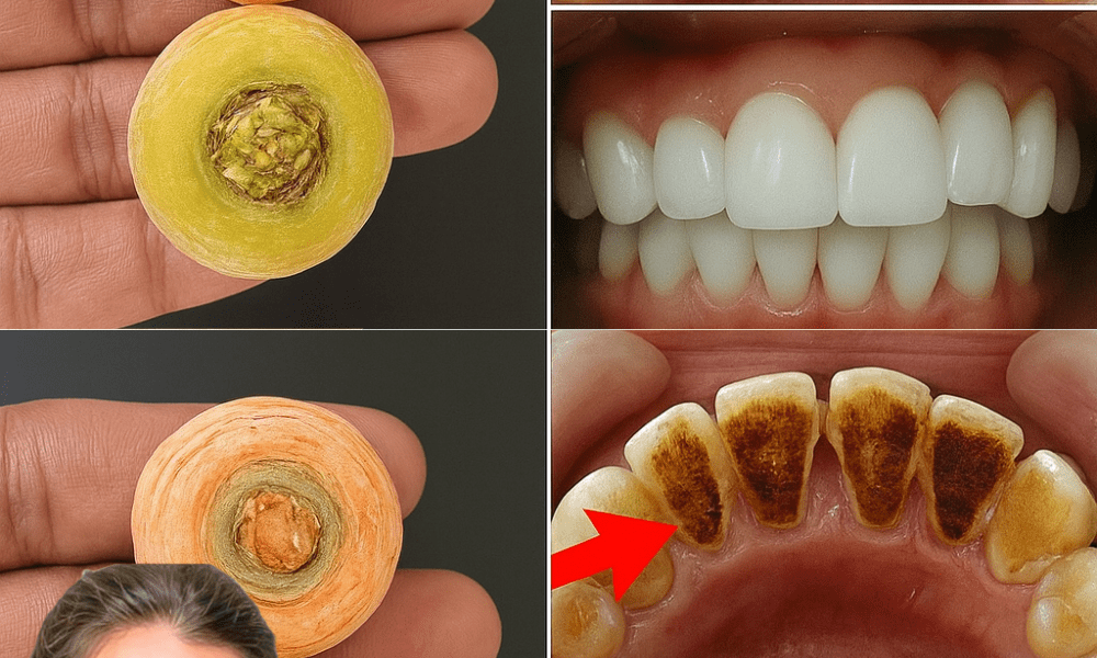 🥕 Brighten Your Smile in Just 2 Minutes! The Surprising Power of Carrot Tops for Naturally White Teeth 🥕 Brighten Your Smile in Just 2 Minutes! The Surprising Power of Carrot Tops for Naturally White Teeth