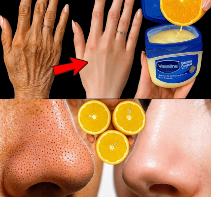 12 Surprising Ways Lemon Can Transform Your Skin: Natural Recipes for a Radiant Glow 12 Surprising Ways Lemon Can Transform Your Skin: Natural Recipes for a Radiant Glow