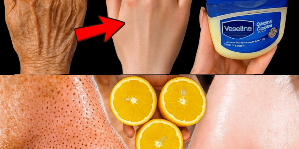 12 Surprising Ways Lemon Can Transform Your Skin: Natural Recipes for a Radiant Glow 12 Surprising Ways Lemon Can Transform Your Skin: Natural Recipes for a Radiant Glow