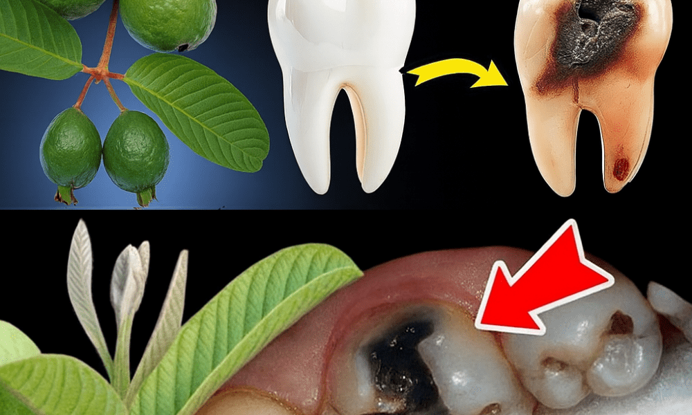 Discover Nature’s Dental Secret: 3 Powerful Guava Leaf Remedies to Fight Tooth Decay Discover Nature’s Dental Secret: 3 Powerful Guava Leaf Remedies to Fight Tooth Decay