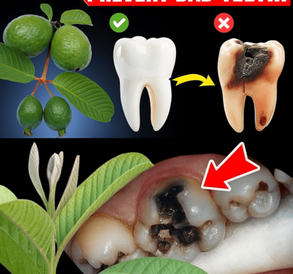 Discover Nature’s Dental Secret: 3 Powerful Guava Leaf Remedies to Fight Tooth Decay Discover Nature’s Dental Secret: 3 Powerful Guava Leaf Remedies to Fight Tooth Decay