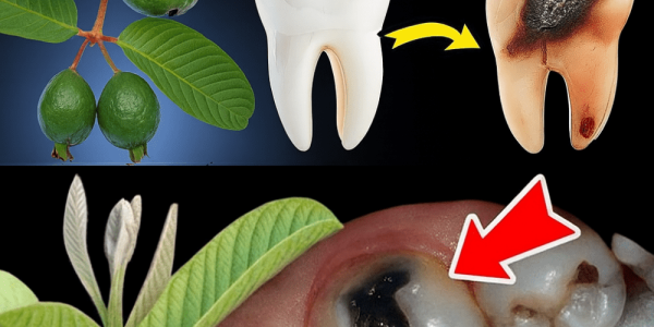 Discover Nature’s Dental Secret: 3 Powerful Guava Leaf Remedies to Fight Tooth Decay