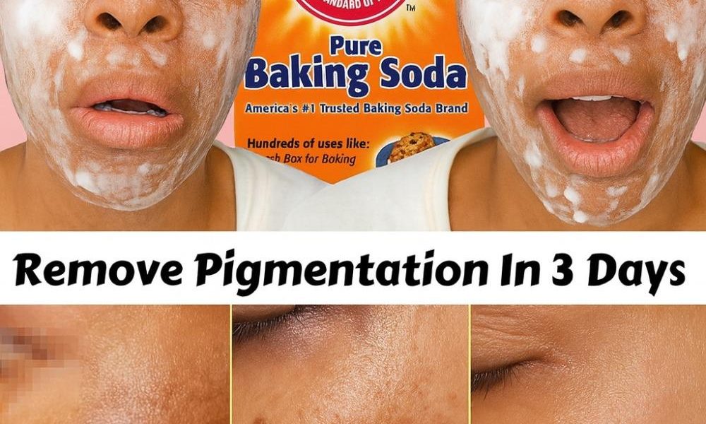 The Baking Soda Cream That Erases Wrinkles and Dark Spots The Baking Soda Cream That Erases Wrinkles and Dark Spots