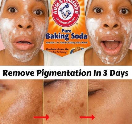 The Baking Soda Cream That Erases Wrinkles and Dark Spots The Baking Soda Cream That Erases Wrinkles and Dark Spots