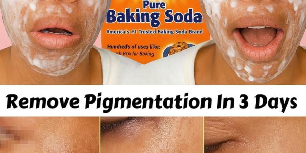 The Baking Soda Cream That Erases Wrinkles and Dark Spots