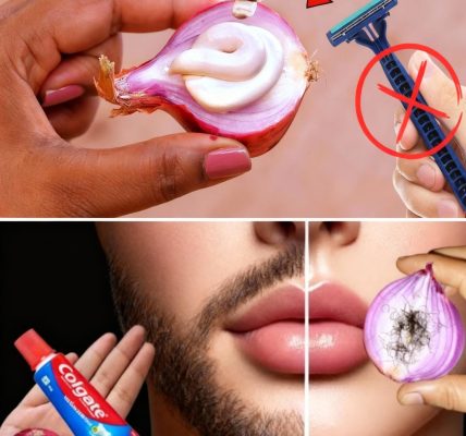 The 2-Minute Natural Hair Removal Hack Thatâs Pain-Free and Permanent The 2-Minute Natural Hair Removal Hack Thatâs Pain-Free and Permanent