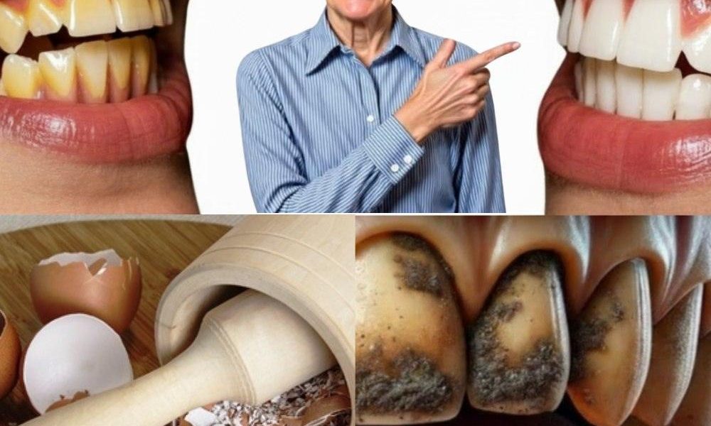 9 Natural Ways to Remove Plaque and Tartar with Eggshells 9 Natural Ways to Remove Plaque and Tartar with Eggshells
