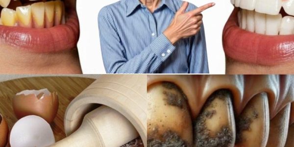 9 Natural Ways to Remove Plaque and Tartar with Eggshells