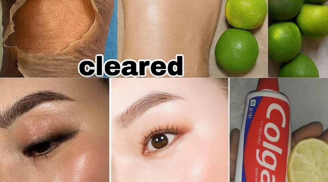 š Glow Up or Myth? The Truth About Lemon and Colgate for Brighter Skin š Glow Up or Myth? The Truth About Lemon and Colgate for Brighter Skin